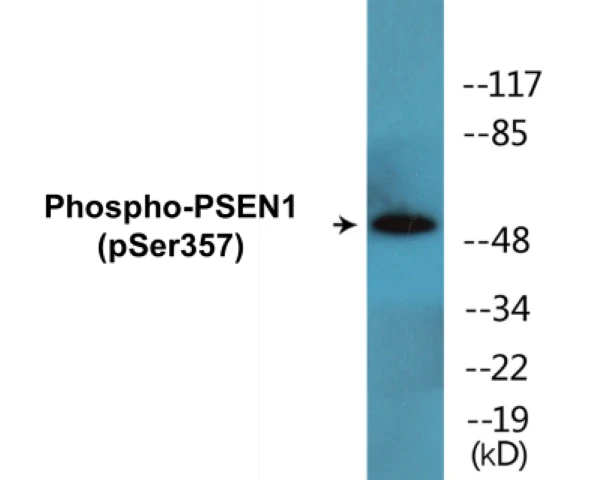 PSEN1 (phospho Ser357) Cell Based ELISA Kit (A102220-296)