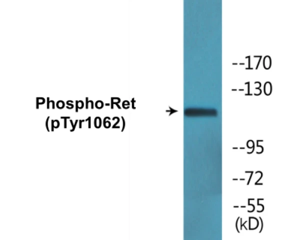 Ret (phospho Tyr1062) Cell Based ELISA Kit (A102257-296)