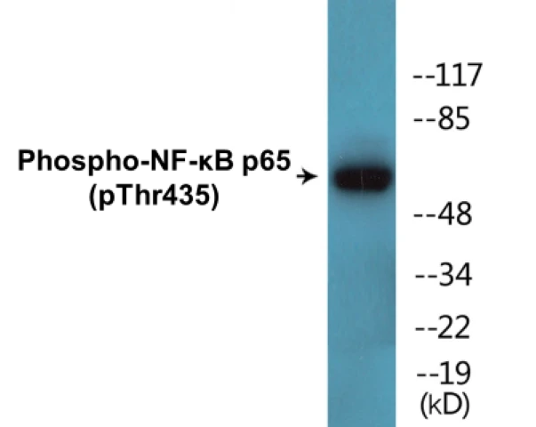 NF-kB p65 (phospho Thr435) Cell Based ELISA Kit (A102558-296)