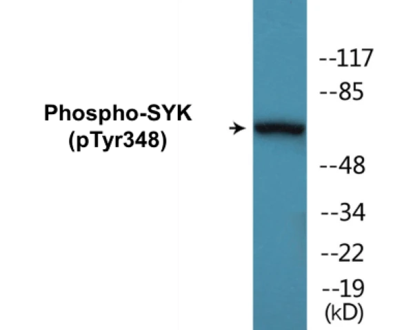 SYK (phospho Tyr348) Cell Based ELISA Kit (A102414-296)