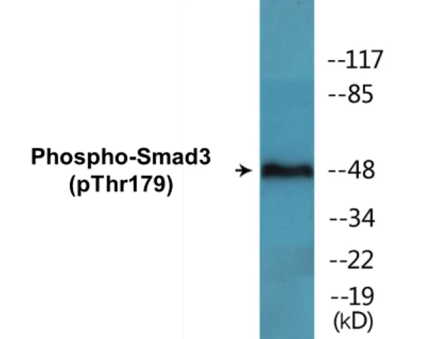 Smad3 (phospho Thr179) Cell Based ELISA Kit (A102187-296)