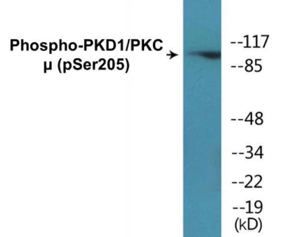 PKD1 (phospho Ser205) Cell Based ELISA Kit (A102306-296)