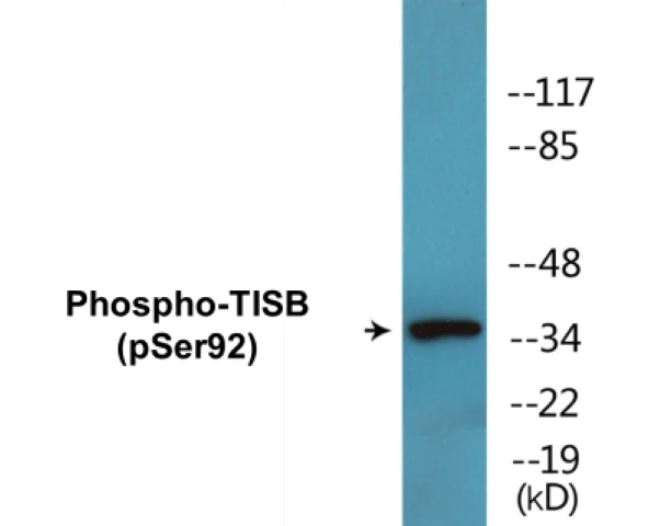 TISB (phospho Ser92) Cell Based ELISA Kit (A102433-296)