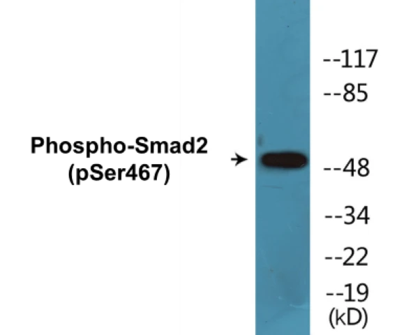 Smad2 (phospho Ser467) Cell Based ELISA Kit (A102135-296)