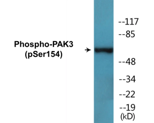 PAK3 (phospho Ser154) Cell Based ELISA Kit (A102352-296)