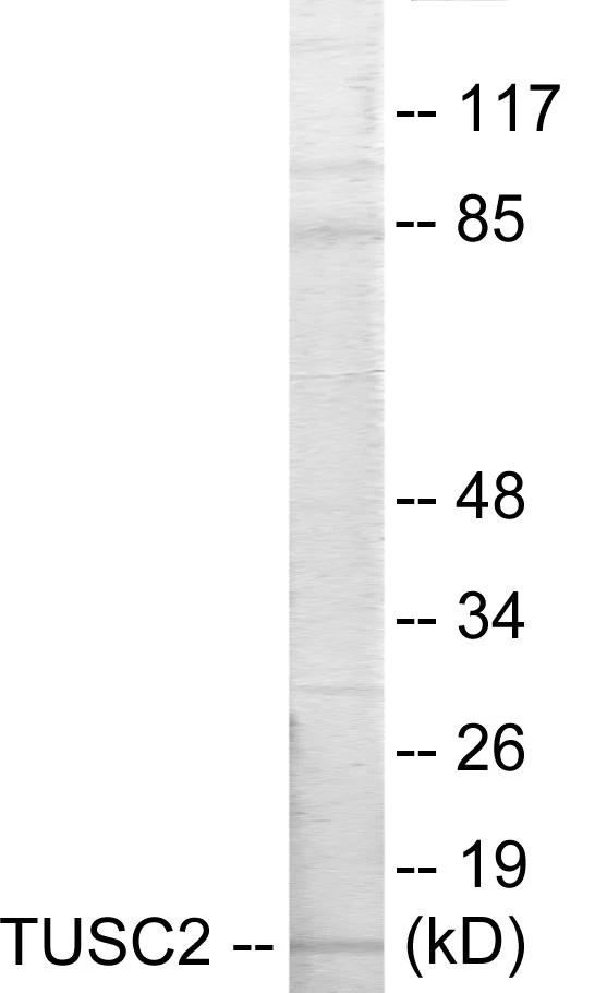 TUSC2 Cell Based ELISA Kit (A103466-96)