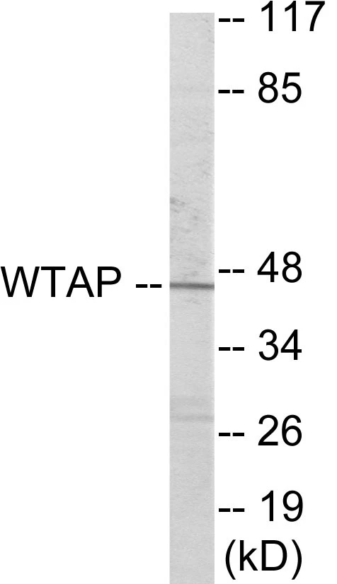 WTAP Cell Based ELISA Kit (A103548-96)