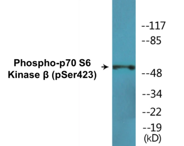 p70S6 Kinase beta (phospho Ser423) Cell Based ELISA Kit (A102597-296)