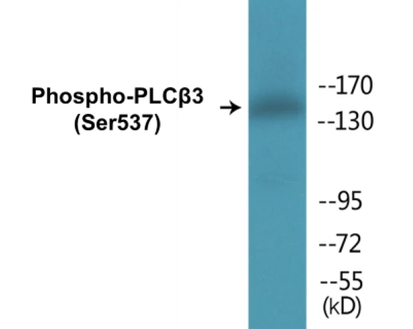 PLC beta 3 (phospho Ser537) Cell Based ELISA Kit (A102518-296)