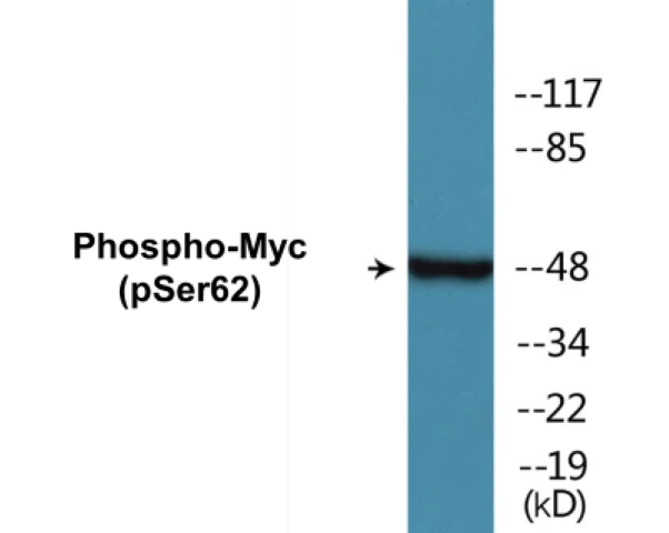 Myc (phospho Ser62) Cell Based ELISA Kit (A102469-296)