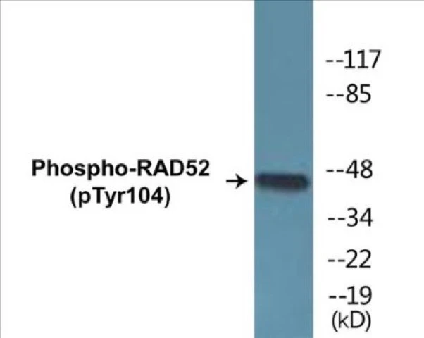 RAD52 (phospho Tyr104) Cell Based ELISA Kit (A102626-296)