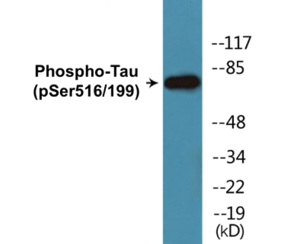 Tau (phospho Ser516 + Ser199) Cell Based ELISA Kit (A102496-296)