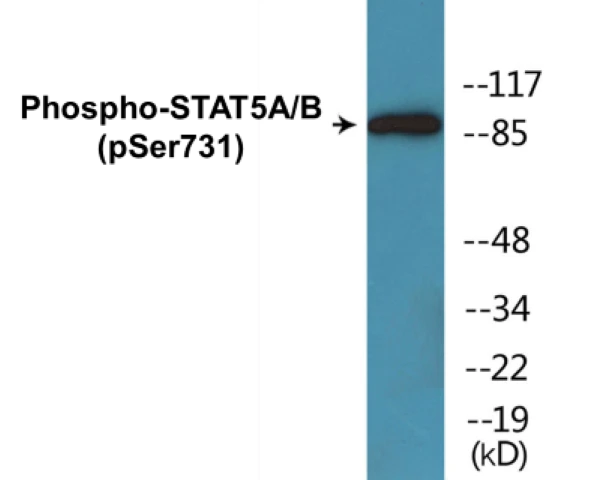 STAT5A + B (phospho Ser731) Cell Based ELISA Kit (A102516-296)