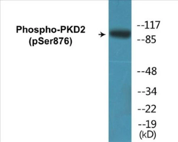 PKD2 (phospho Ser876) Cell Based ELISA Kit (A102266-296)