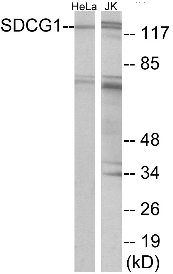 SDCG1 Cell Based ELISA Kit (A103133-96)