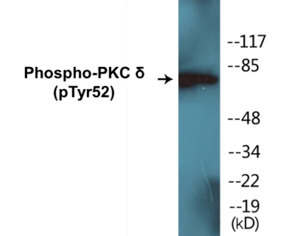 PKC delta (phospho Tyr52) Cell Based ELISA Kit (A102581-296)