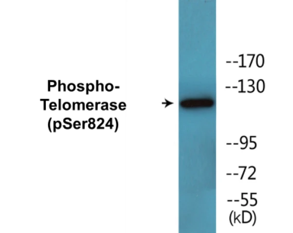 Telomerase (phospho Ser824) Cell Based ELISA Kit (A102772-296)