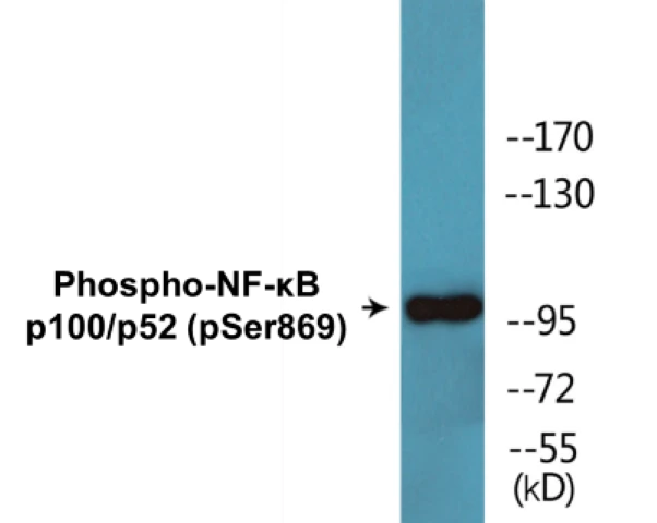 NF-kB p100 / p52 (phospho Ser869) Cell Based ELISA Kit (A102120-296)