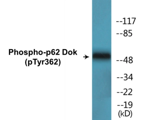 p62 Dok (phospho Tyr362) Cell Based ELISA Kit (A102059-296)