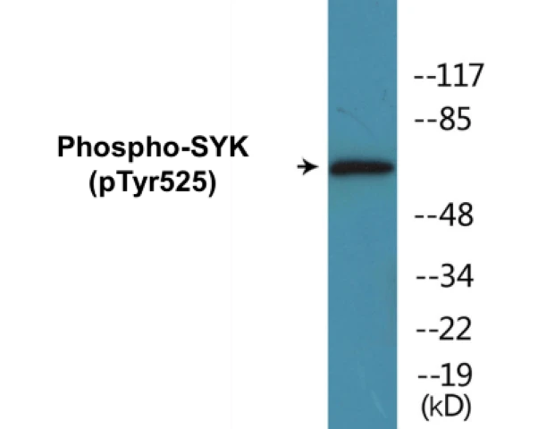 SYK (phospho Tyr525) Cell Based ELISA Kit (A103834-296)