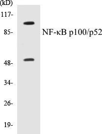 NFkB p100 / p52 Cell Based ELISA Kit (A102828-96)