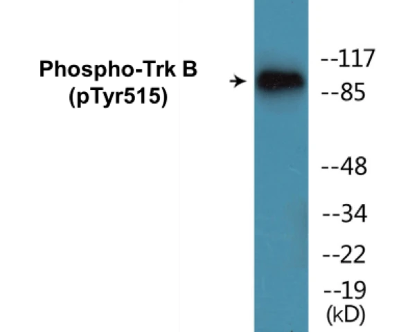 TrkB (phospho Tyr515) Cell Based ELISA Kit (A102270-296)