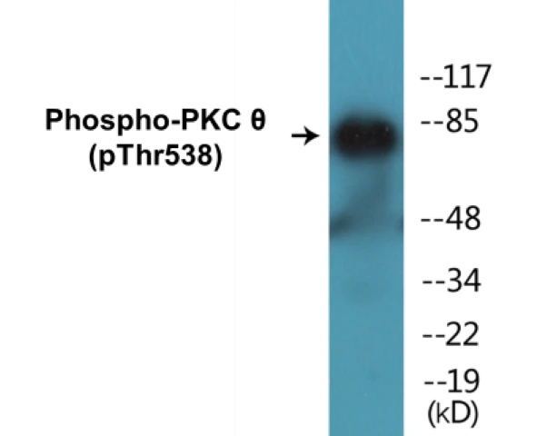 PKC theta (phospho Thr538) Cell Based ELISA Kit (A102530-296)