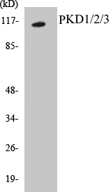 PKD1 + 2 + 3 Cell Based ELISA Kit (A102858-96)