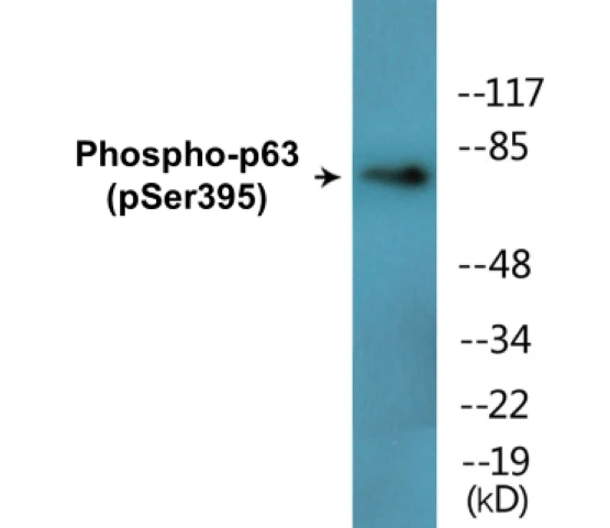 p63 (phospho Ser395) Cell Based ELISA Kit (A102455-296)