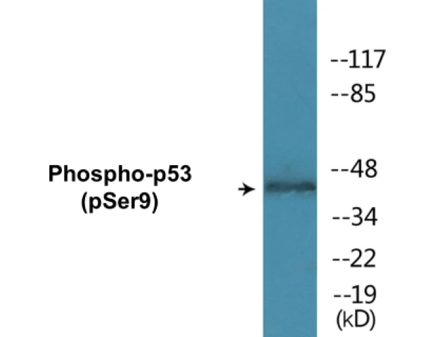 p53 (phospho Ser9) Cell Based ELISA Kit (A102768-296)