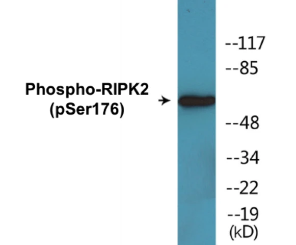 RIPK2 (phospho Ser176) Cell Based ELISA Kit (A102611-296)