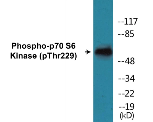 p70S6 Kinase (phospho Thr229) Cell Based ELISA Kit (A102483-296)