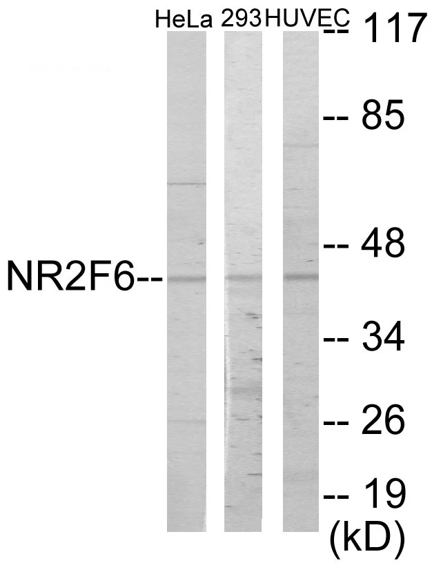 NR2F6 Cell Based ELISA Kit (A103039-96)