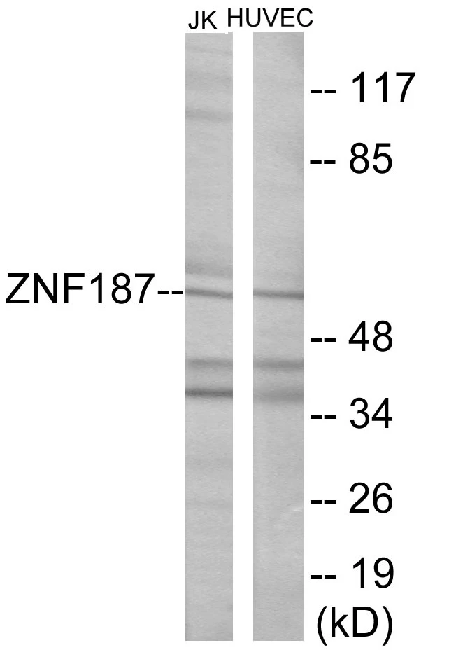 ZNF187 Cell Based ELISA Kit (A103661-96)