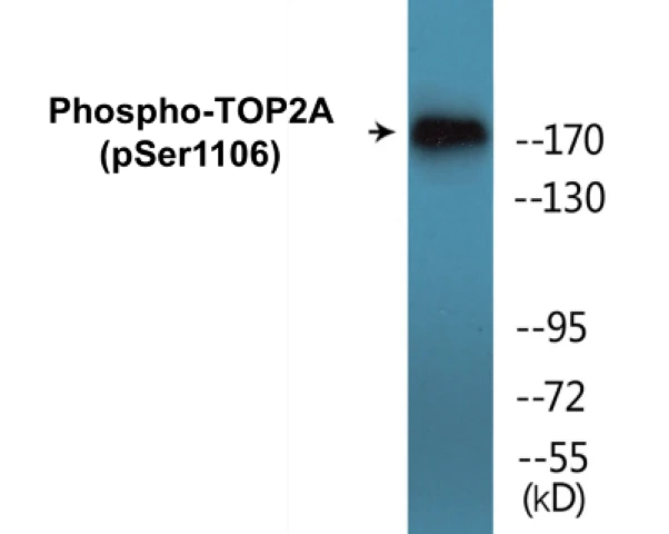 TOP2A (phospho Ser1106) Cell Based ELISA Kit (A102709-296)