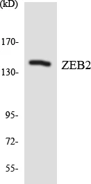 ZEB2 Cell Based ELISA Kit (A103268-96)