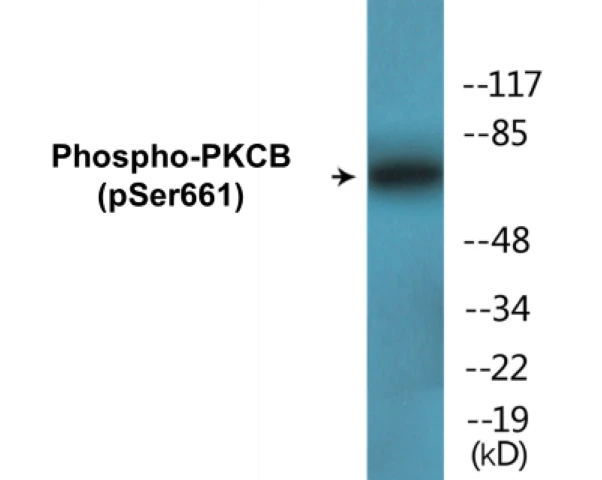 PKCB (phospho Ser661) Cell Based ELISA Kit (A102283-296)