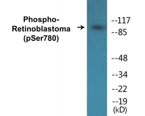 Retinoblastoma (phospho Ser780) Cell Based ELISA Kit (A102372-296)