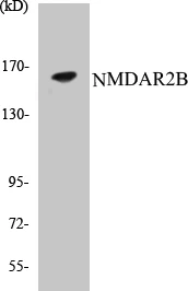 NMDAR2B Cell Based ELISA Kit (A102970-96)