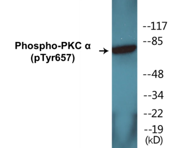 PKC alpha (phospho Tyr657) Cell Based ELISA Kit (A102546-296)