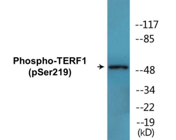 TERF1 (phospho Ser219) Cell Based ELISA Kit (A102628-296)