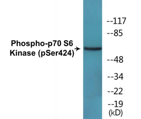 p70S6 Kinase (phospho Ser424) Cell Based ELISA Kit (A102485-296)