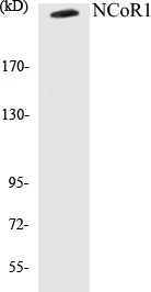 NCoR1 Cell Based ELISA Kit (A103427-96)