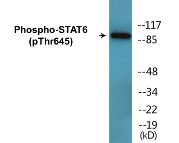 STAT6 (phospho Thr645) Cell Based ELISA Kit (A102148-296)