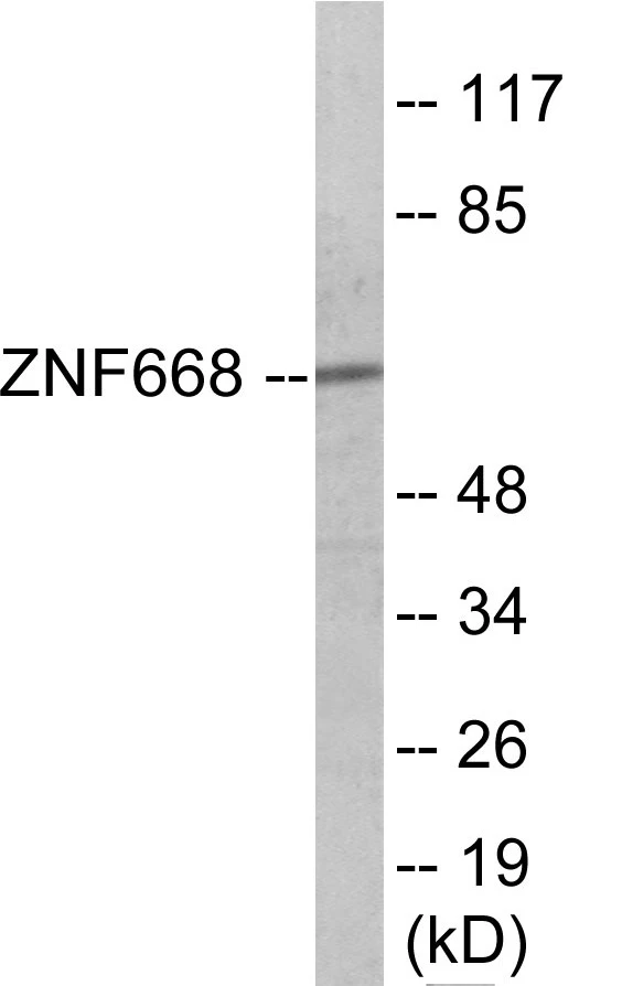 ZNF668 Cell Based ELISA Kit (A103422-96)