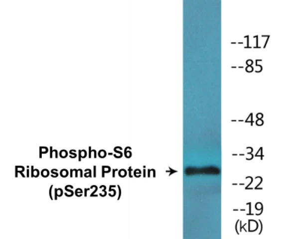 S6 Ribosomal Protein (phospho Ser235) Cell Based ELISA Kit (A102460-296)