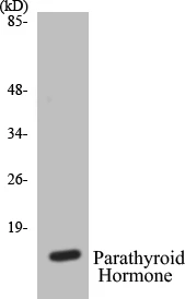 Parathyroid Hormone Cell Based ELISA Kit (A103600-96)