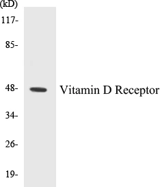 Vitamin D Receptor Cell Based ELISA Kit (A103607-96)