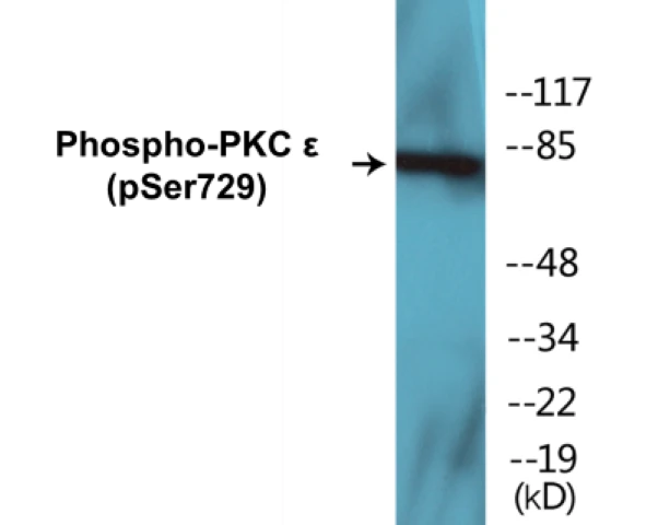 PKC epilison (phospho Ser729) Cell Based ELISA Kit (A102491-296)