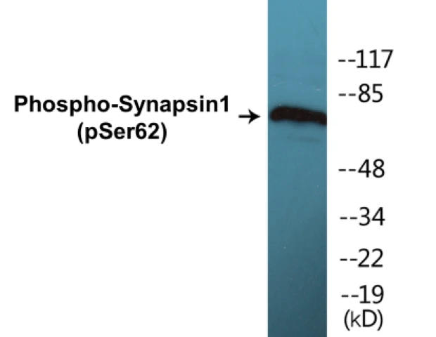 Synapsin 1 (phospho Ser62) Cell Based ELISA Kit (A102542-296)